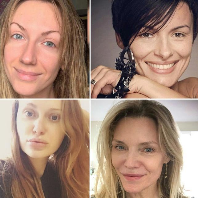 До и после: знаменитости показали свои настоящие лица - 1 - изображение
