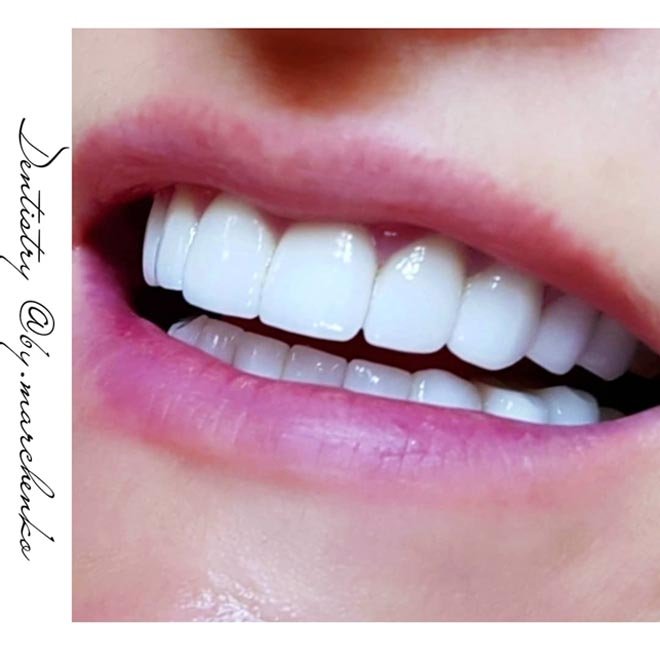 Стоматолог Наталья Марченко: «Не забывайте улыбаться» - 3 - изображение